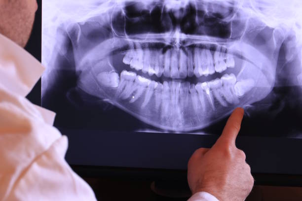 Best Emergency Denture Repair in Frankfort Square, IL