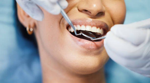 Best Emergency Treatment for Oral Infections in Frankfort Square, IL